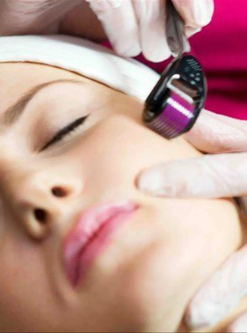 Derma roller la solution miracle 1er choix
