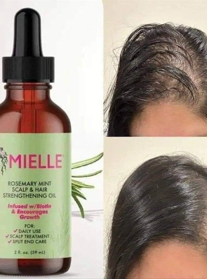 ✨ Huile Mielle Originale pour allonger et renforcer les cheveux 🌱
